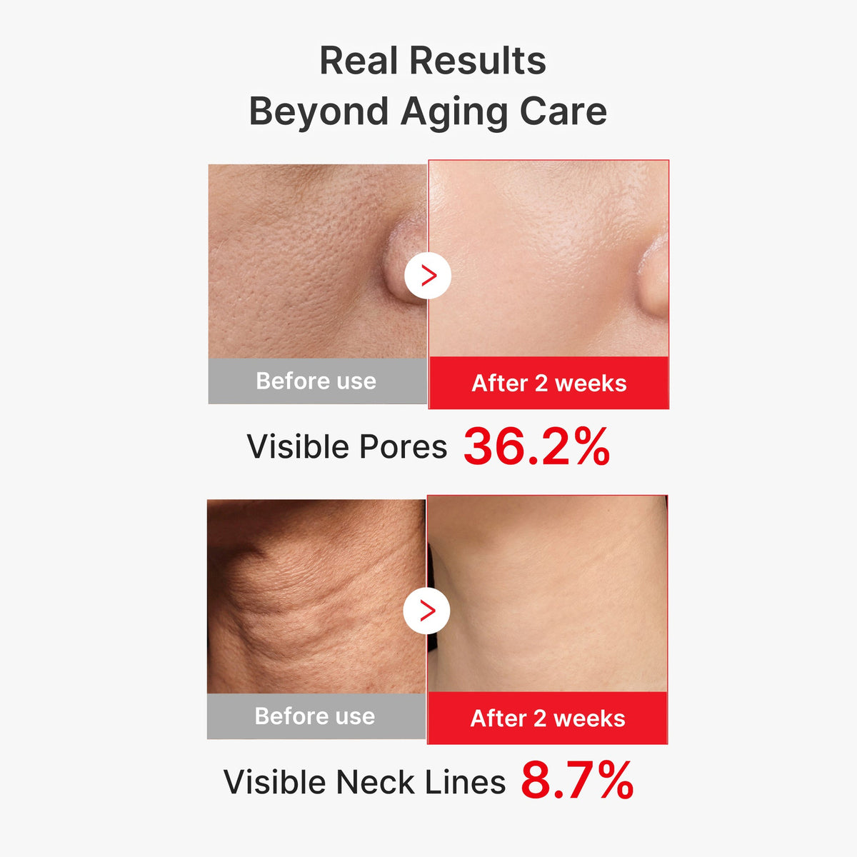 Resultados cosméticos de Medicube EGF NAD+ Firming Serum