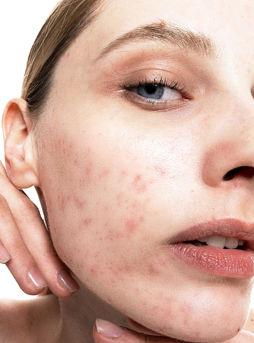 ALLIES OF SKIN | Azelaic & Kojic Advanced Clarifying Serum - 30ml