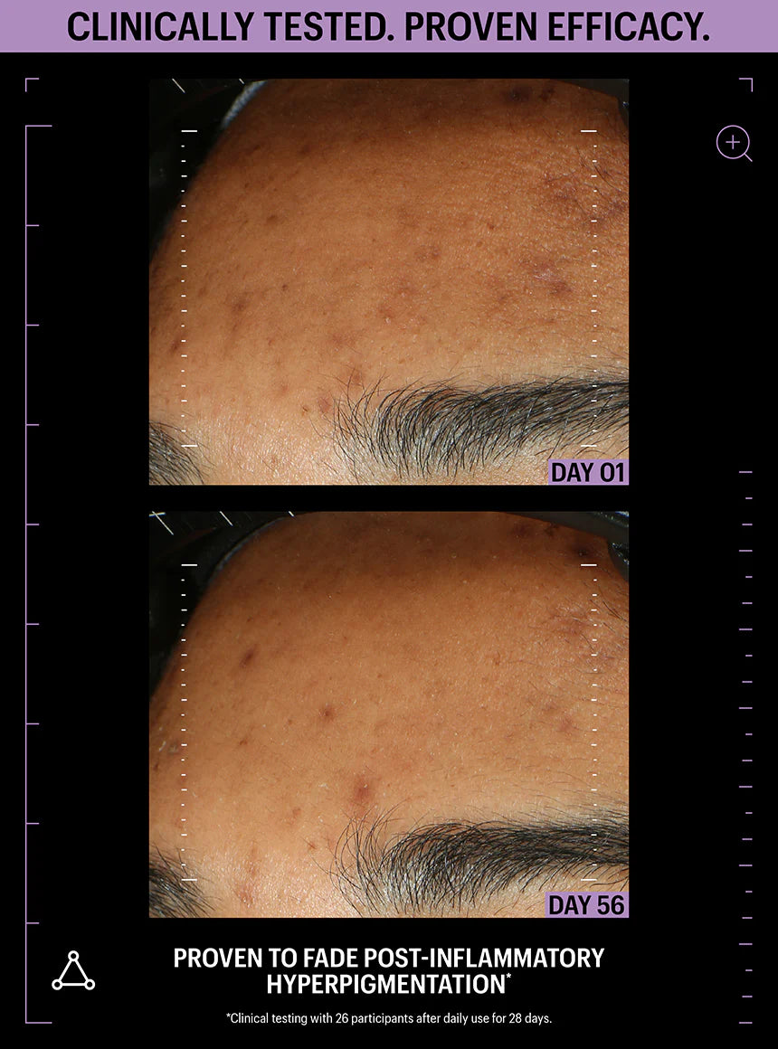 ALLIES OF SKIN | Azelaic & Kojic Advanced Clarifying Serum - 30ml