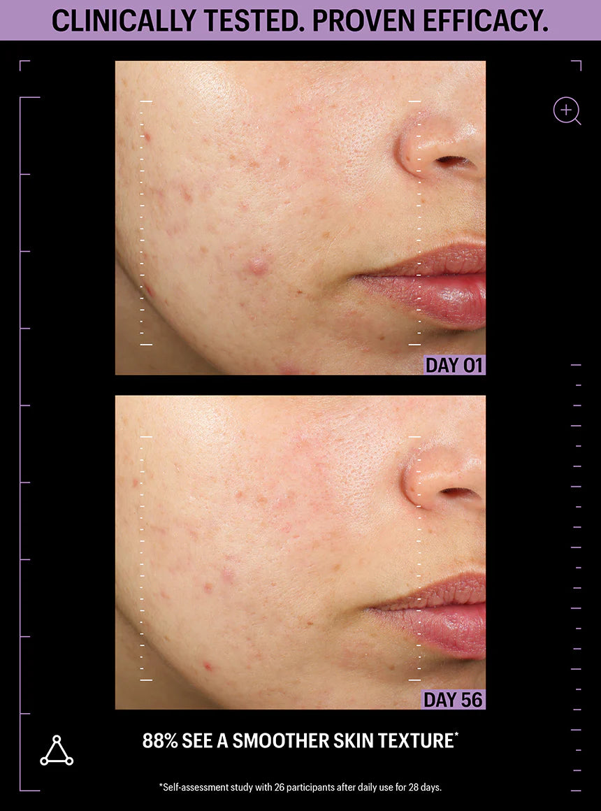 ALLIES OF SKIN | Azelaic & Kojic Advanced Clarifying Serum - 30ml