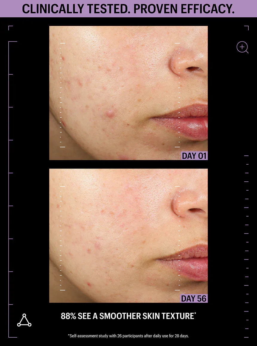 ALLIES OF SKIN | Azelaic & Kojic Advanced Clarifying Serum - 30ml - InternationalCosmetic