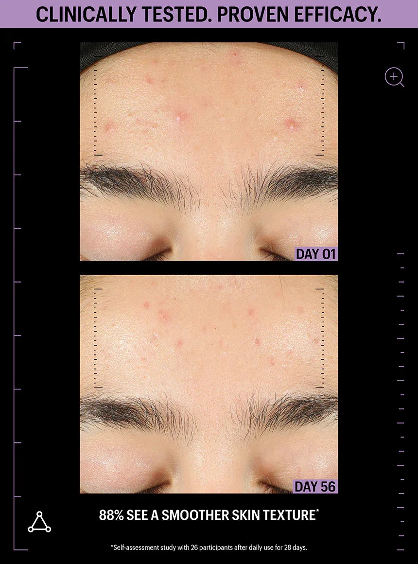 ALLIES OF SKIN | Azelaic & Kojic Advanced Clarifying Serum - 30ml - InternationalCosmetic