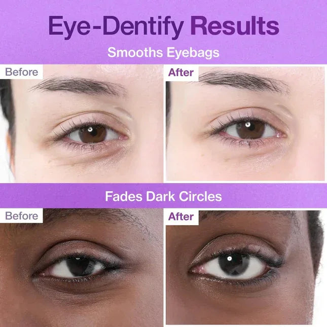 NUMBUZIN | No.9 NAD+ Collagen Under Eye Patches (5 pairs) - InternationalCosmetic