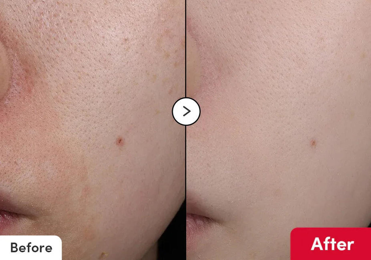 EQQUALBERRY | Vitamin Illuminating Serum 30ml