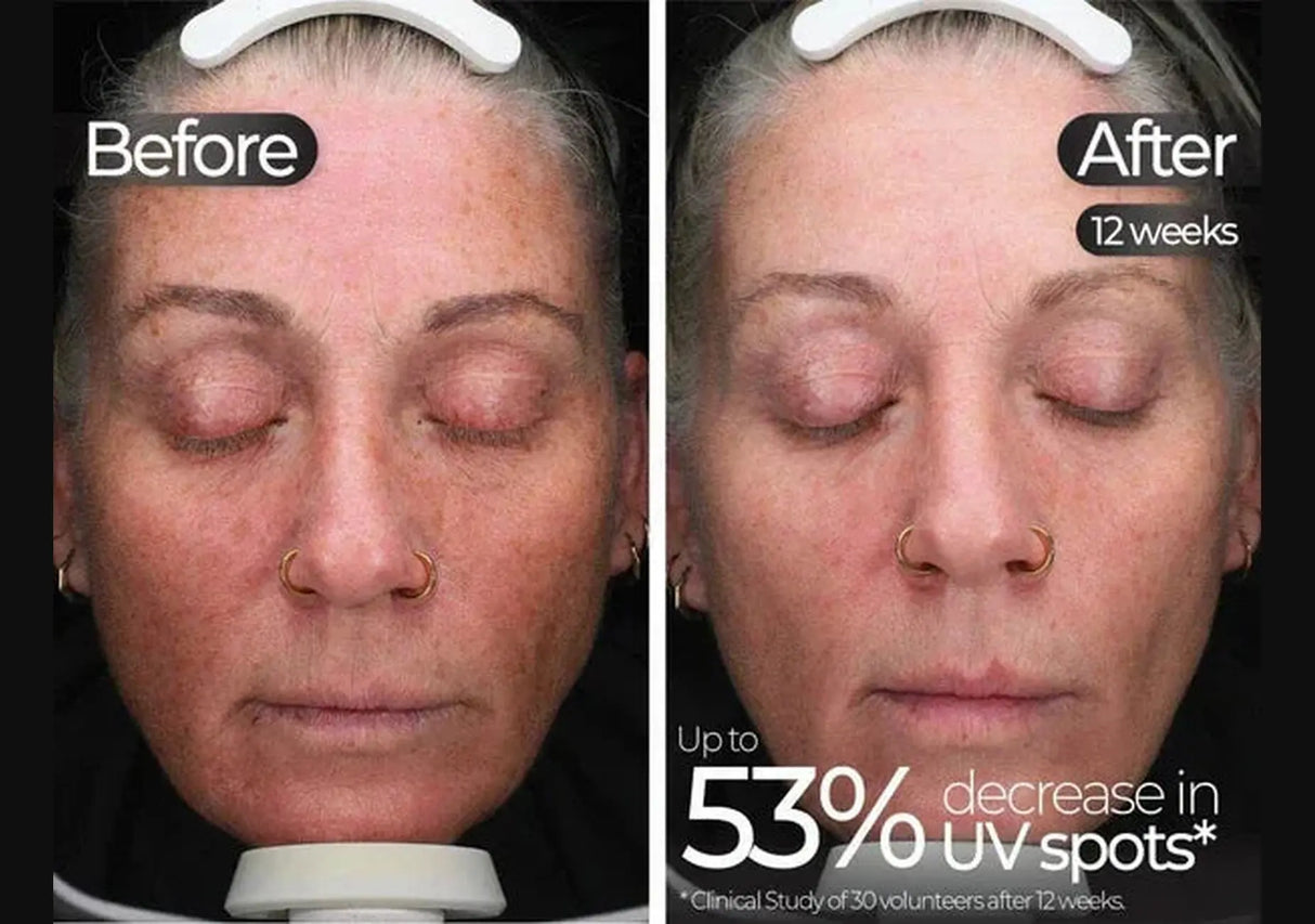 STYLPRO | Wavelength Pro 5-in-1 LED Mask