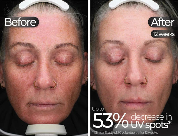 STYLPRO | Wavelength Pro 5-in-1 LED Mask - InternationalCosmetic