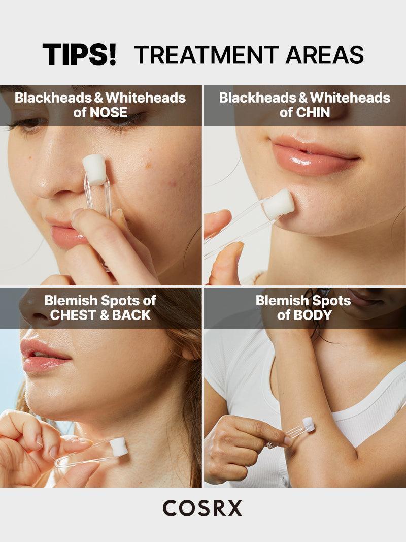 COSRX | The AHA 2 BHA 2 Blemish Treatment - 50gr - InternationalCosmetic