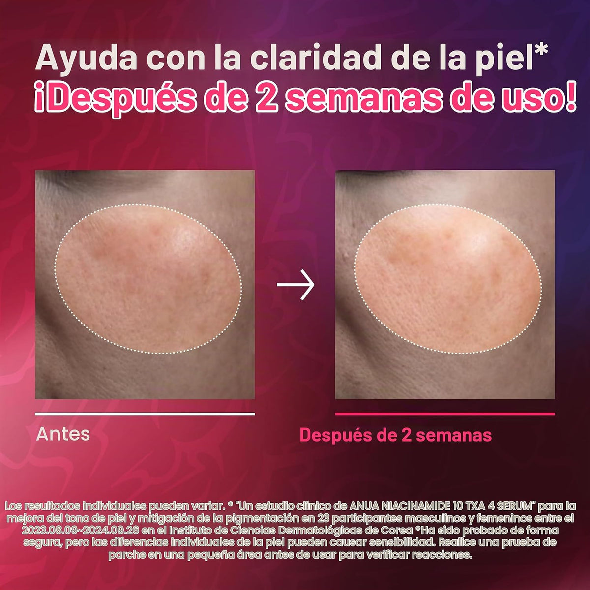 ANUA | Niacinamide 10 + TXA 3 Serum K-Pop Demon Hunters - 50ml