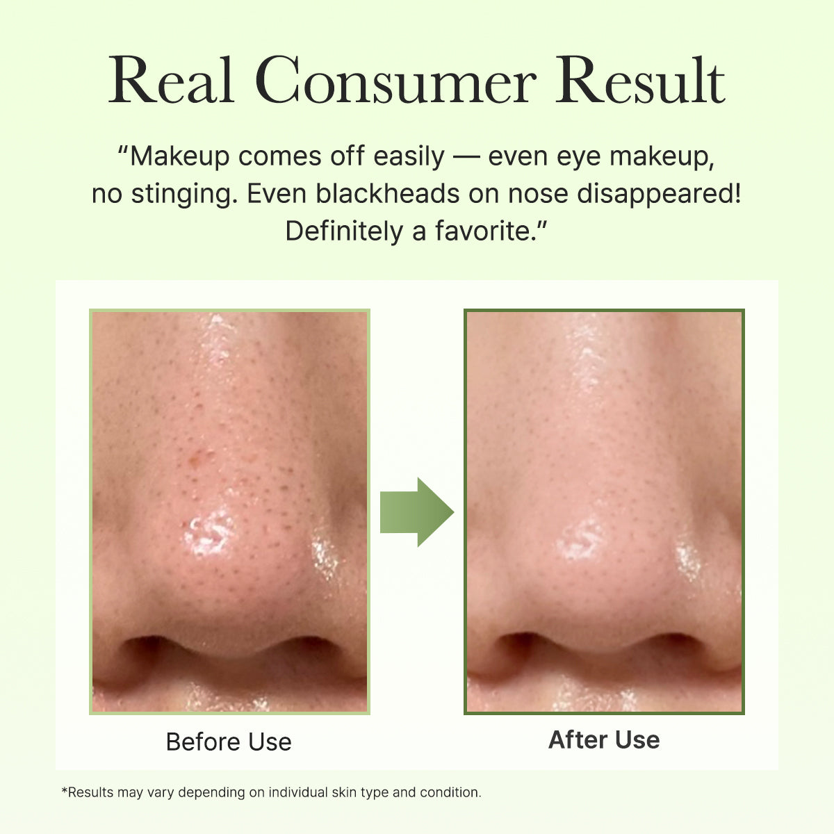 ARENCIA | Pore Melt Phyto PDRN Cleansing Balm - 90 ml