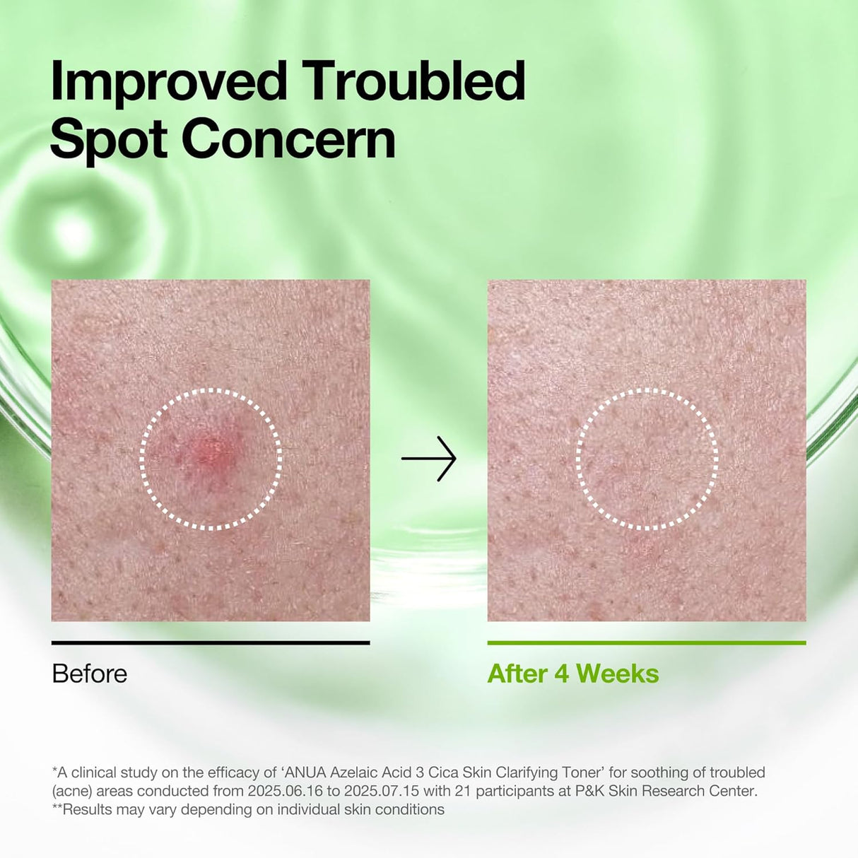 ANUA | Azelaic Acid 3 Cica Skin Clarifying Toner - 250ml