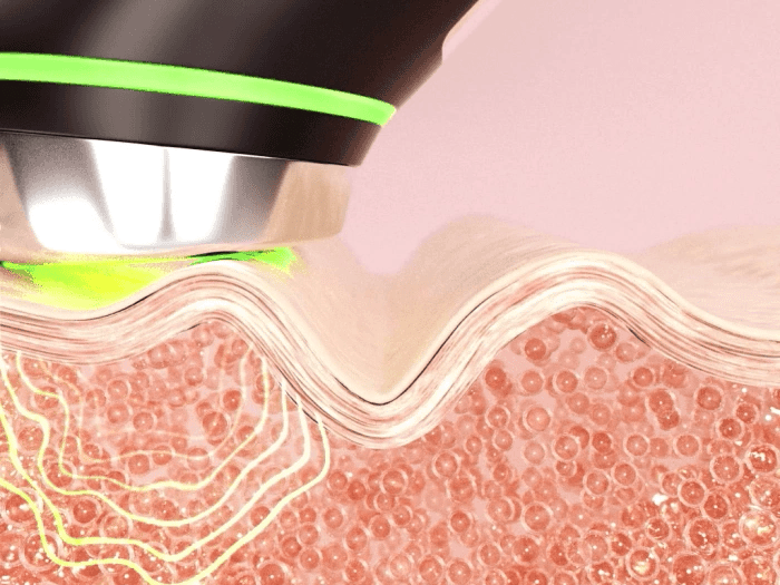 MEDICUBE | AGE - R Booster Pro - Negro