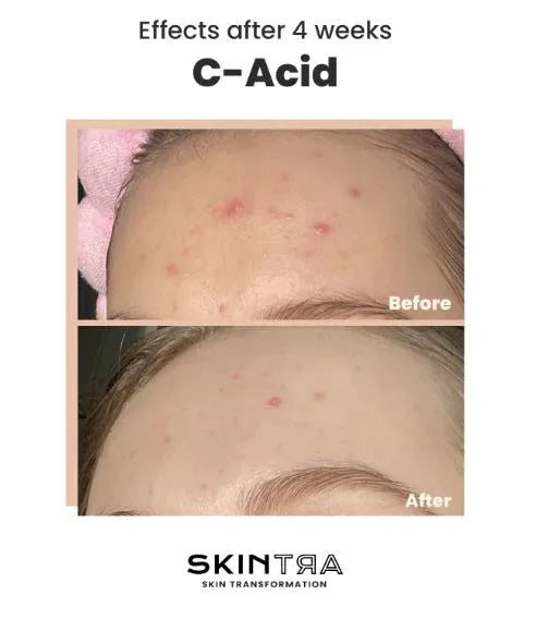 SKINTRA | C-Acid - 30ml - InternationalCosmetic