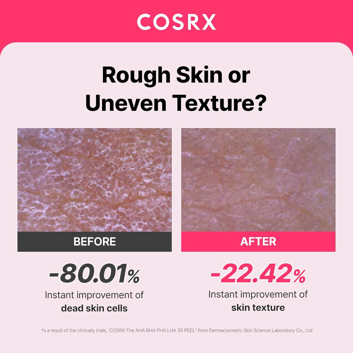 COSRX | The AHA BHA PHA LHA 35 Peel - 30ml