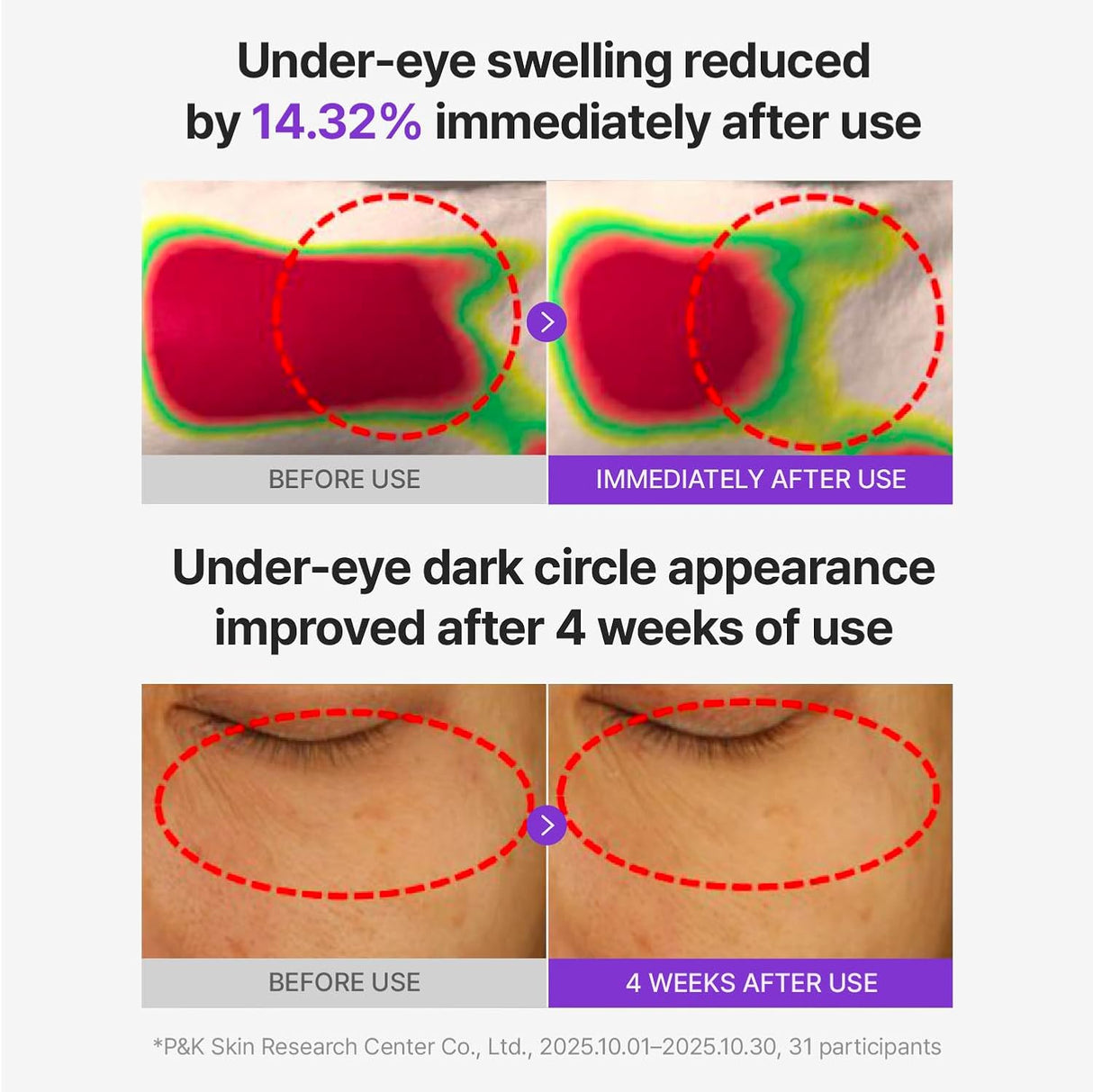 CENTELLIAN 24 | 360º Shot PDRN Glowing Eye Patch - 6ud
