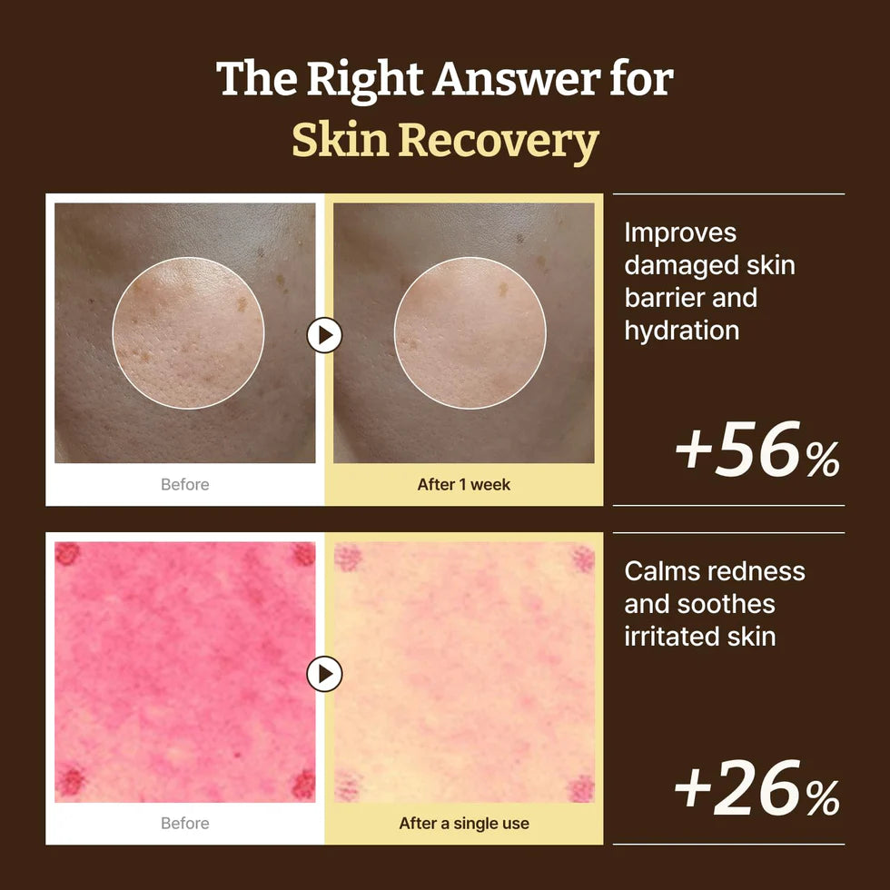 DR.REJU-ALL| Advanced PDRN Rejuvenating Cream