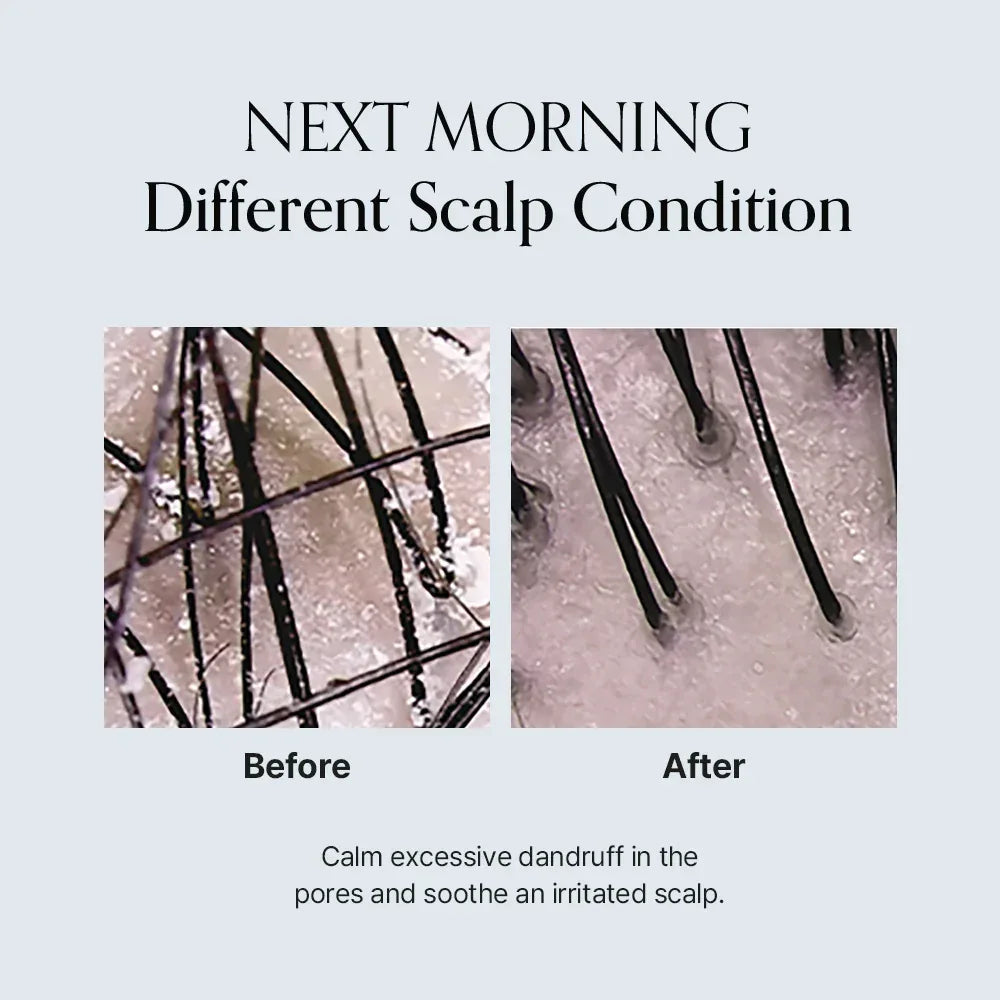 GROWUS | Damage Therapy Scalp Ampoule - 50ml - InternationalCosmetic