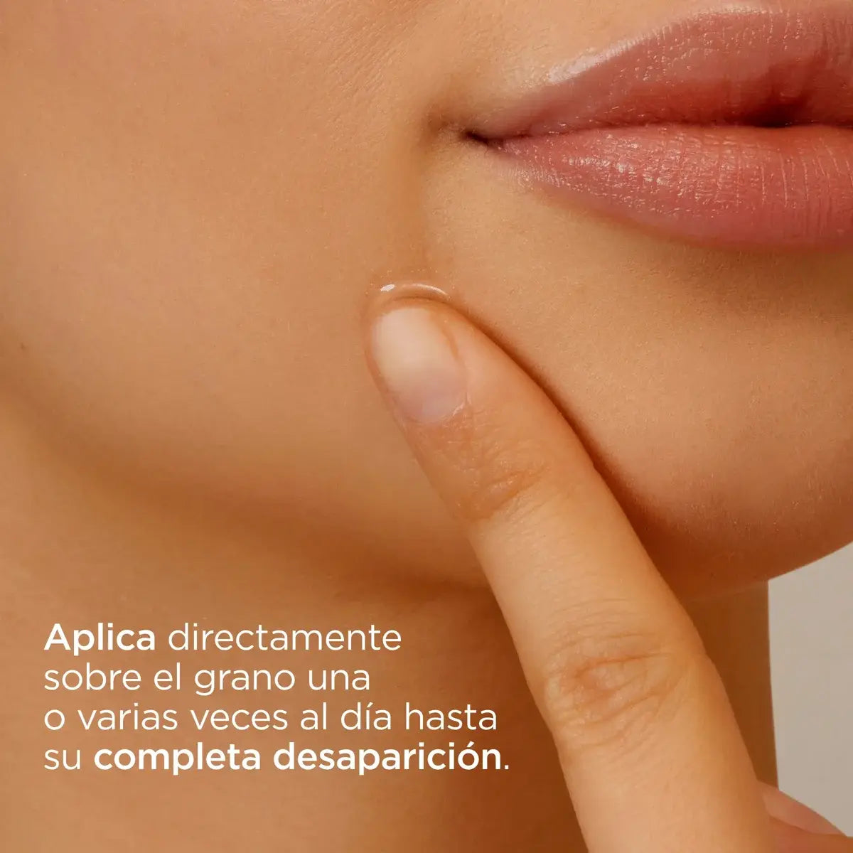 ISDIN | Acniben On The Spot - 15ml