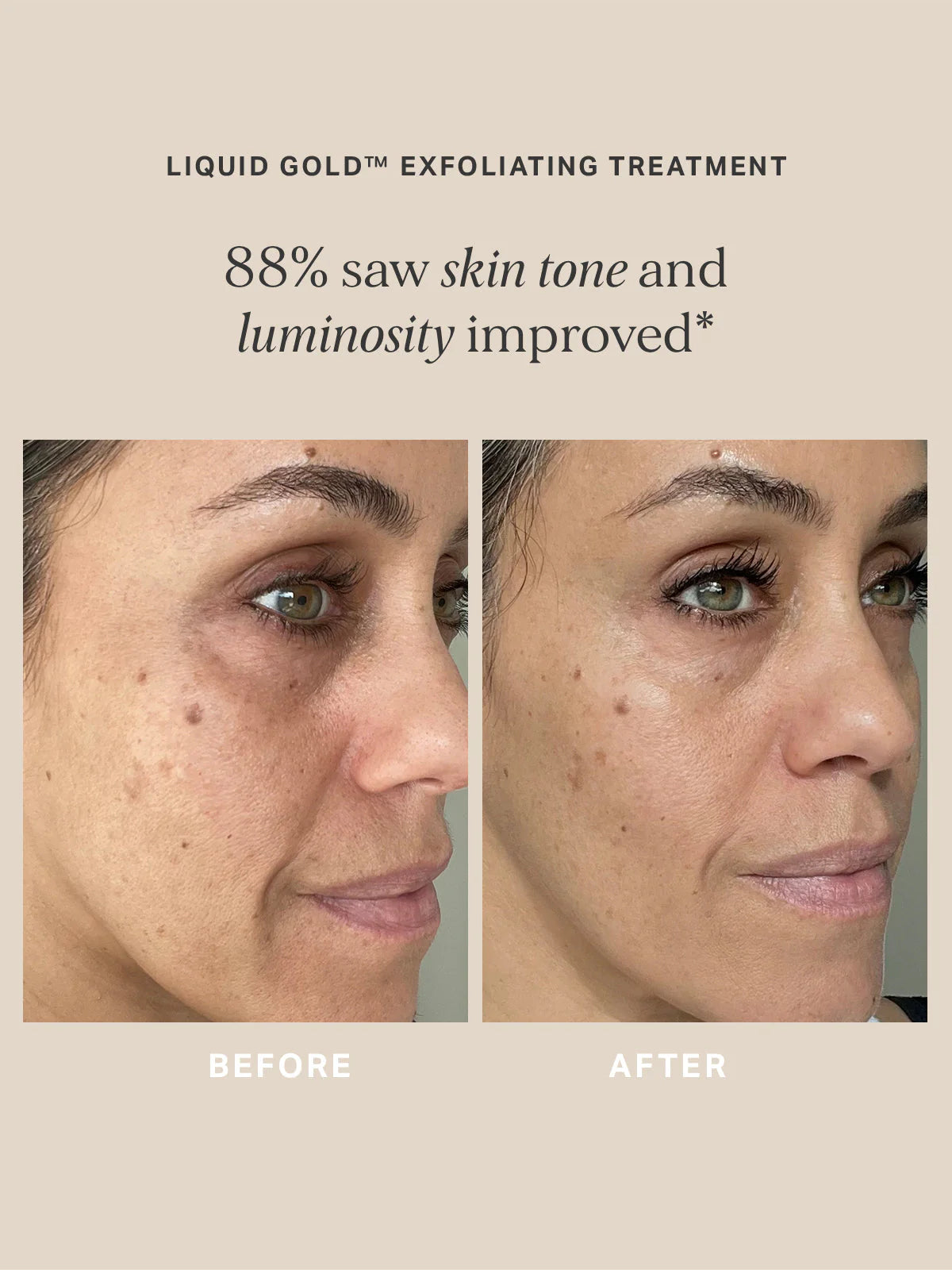 ALPHA-H | Liquid Gold