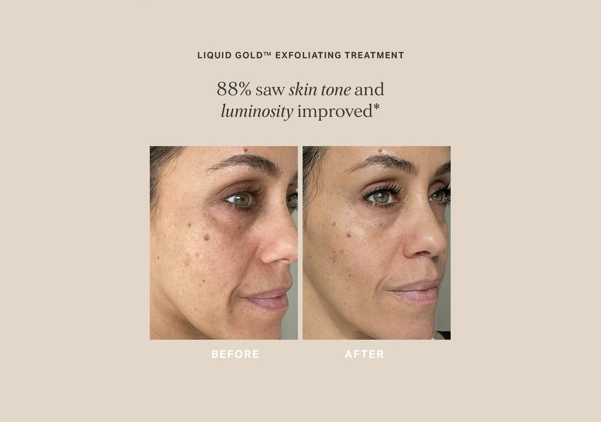 ALPHA-H | Liquid Gold