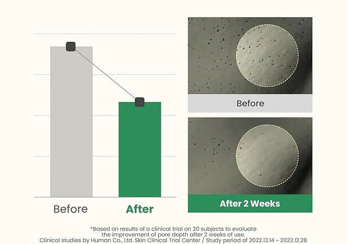 AXIS-Y | LHA Peel & Fill Pore Balancing Cream - 50ml