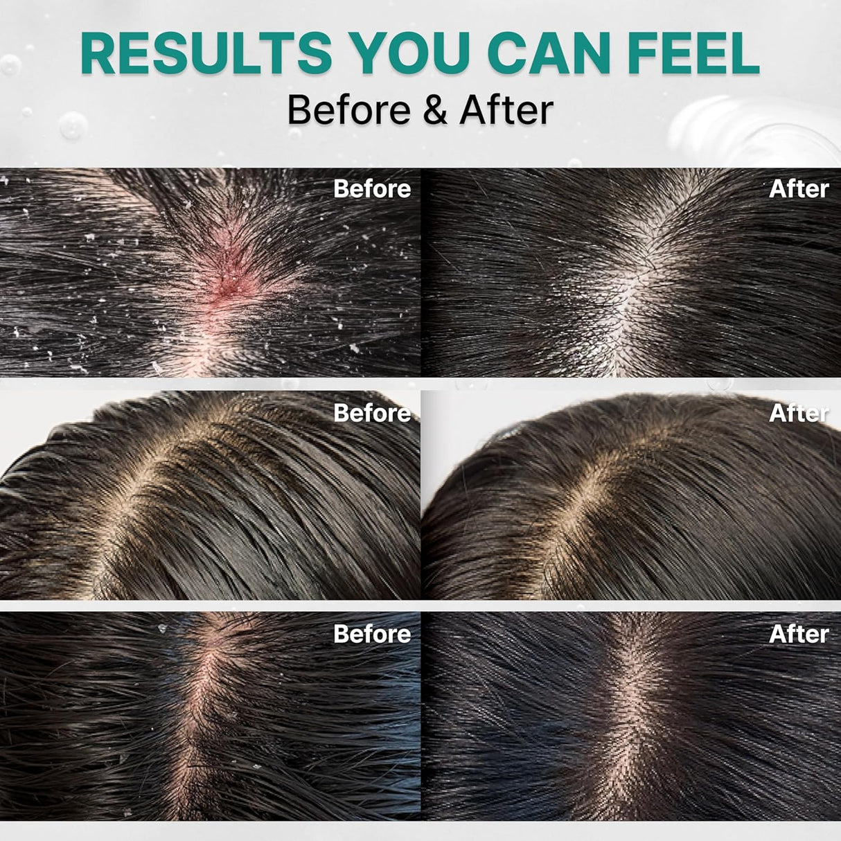 LILYEVE | Scalp: Turn Cica PDRN Deep Clean Shampoo - 500gr