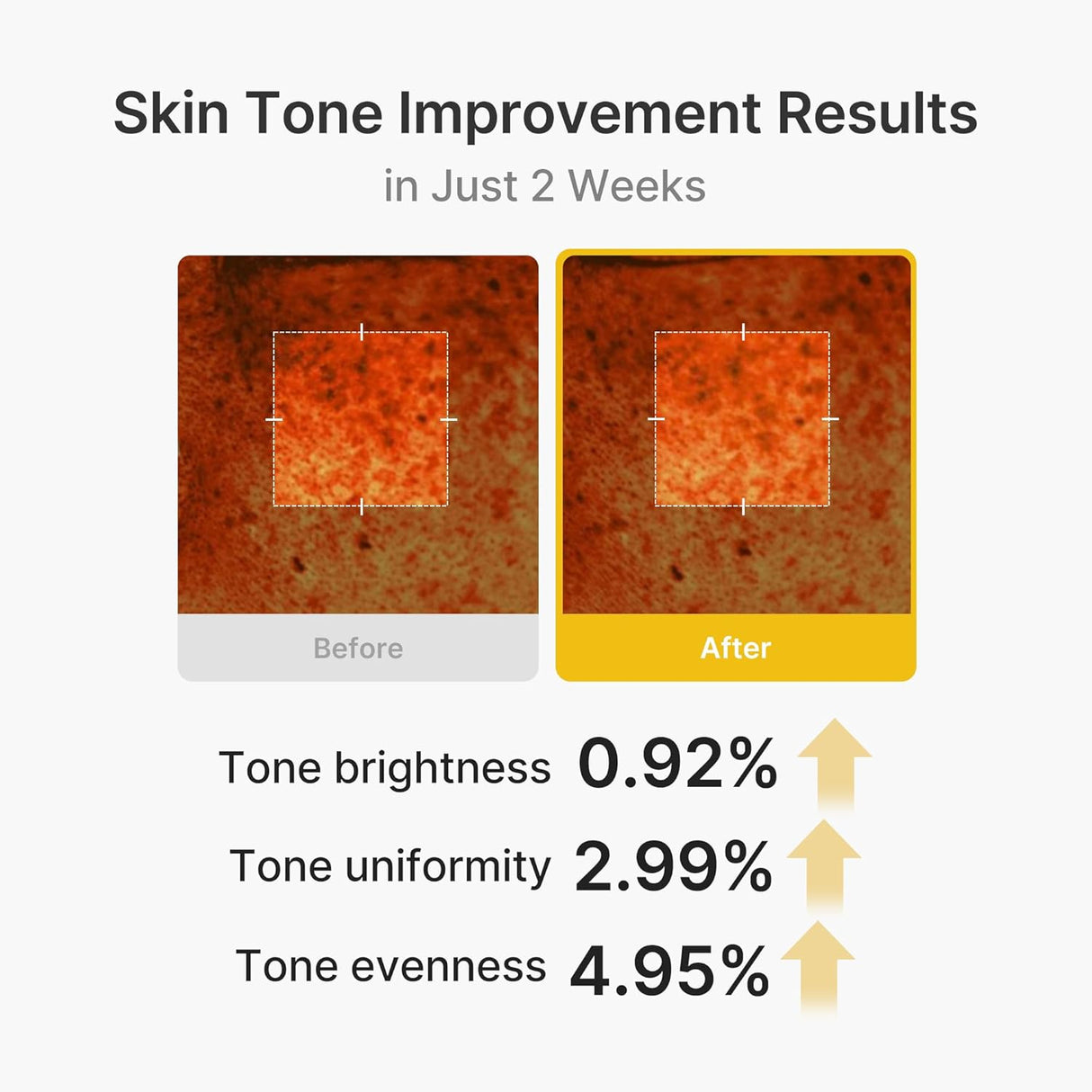 MEDICUBE | Kojic Acid Turmeric Vita Capsule Cream - 53gr