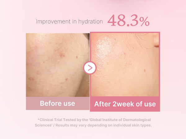 MEDICUBE | PDRN Pink Niacinamide Milky Toner - 150ml