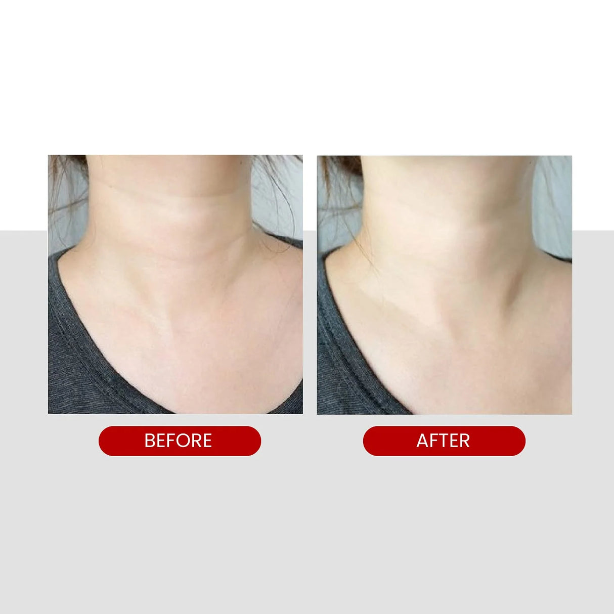 MEDIPEEL | Peptide Naite 1000 Shot Neck Stick - 20gr