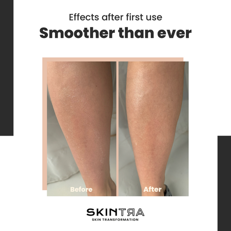 Skintra Mr. Smoother