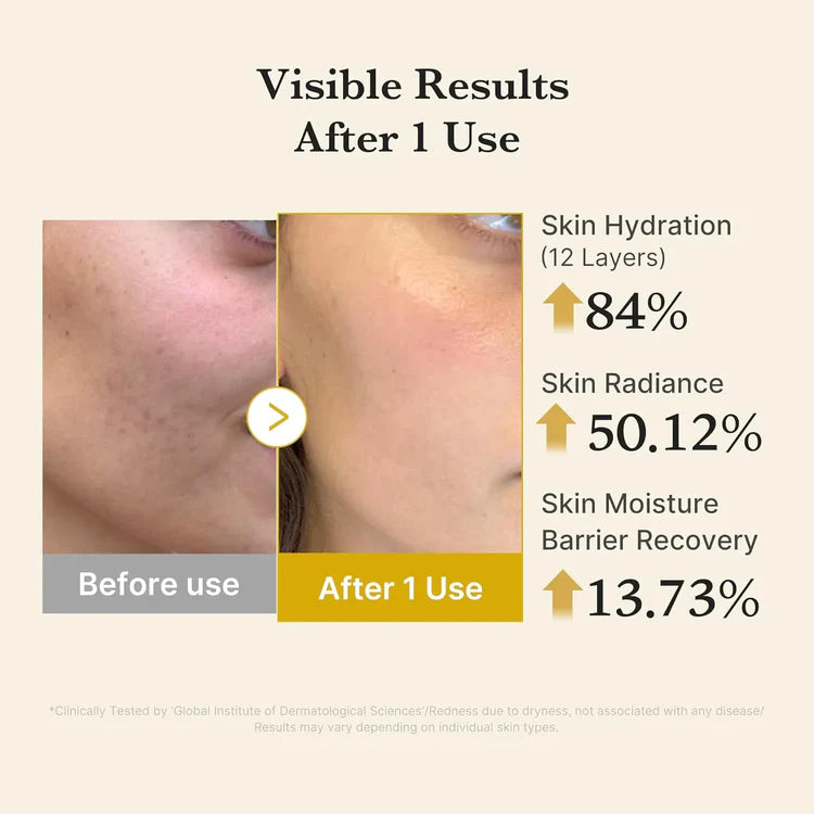 MEDICUBE | Kojic Acid Turmeric Vita Jelly Mist Serum - 100ml