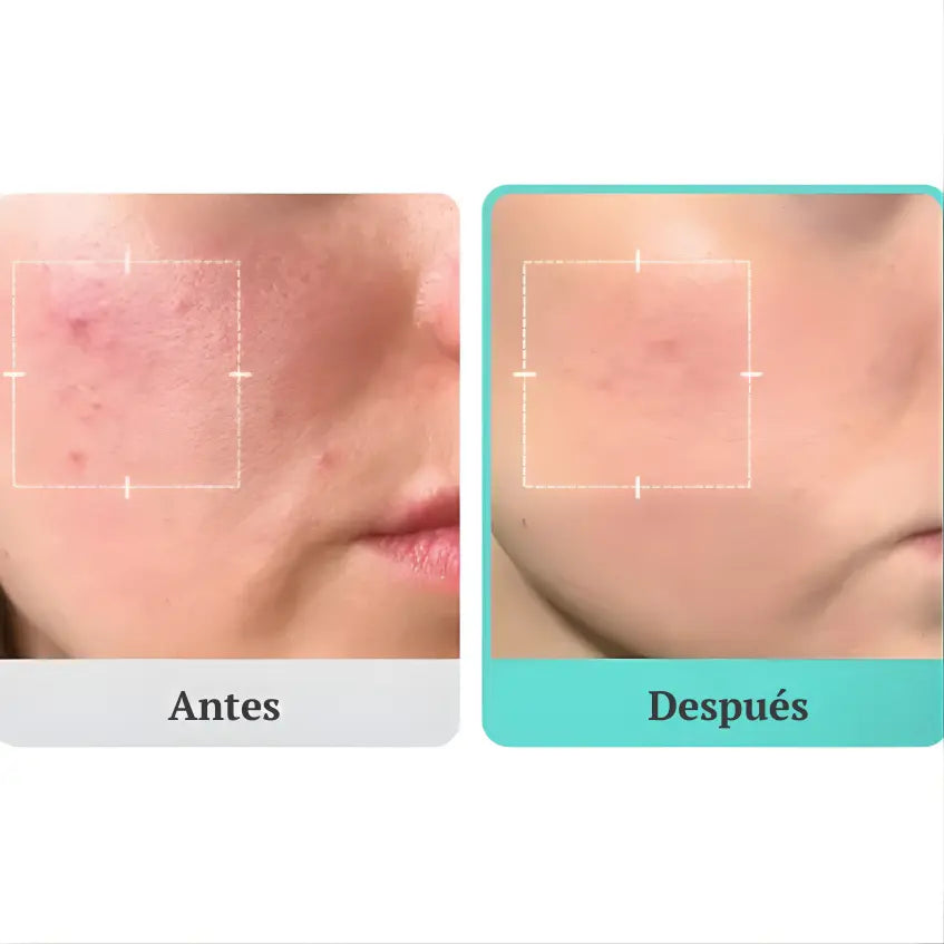 MEDICUBE | Azelaic Acid 16 BB Soothing Serum - 30ml