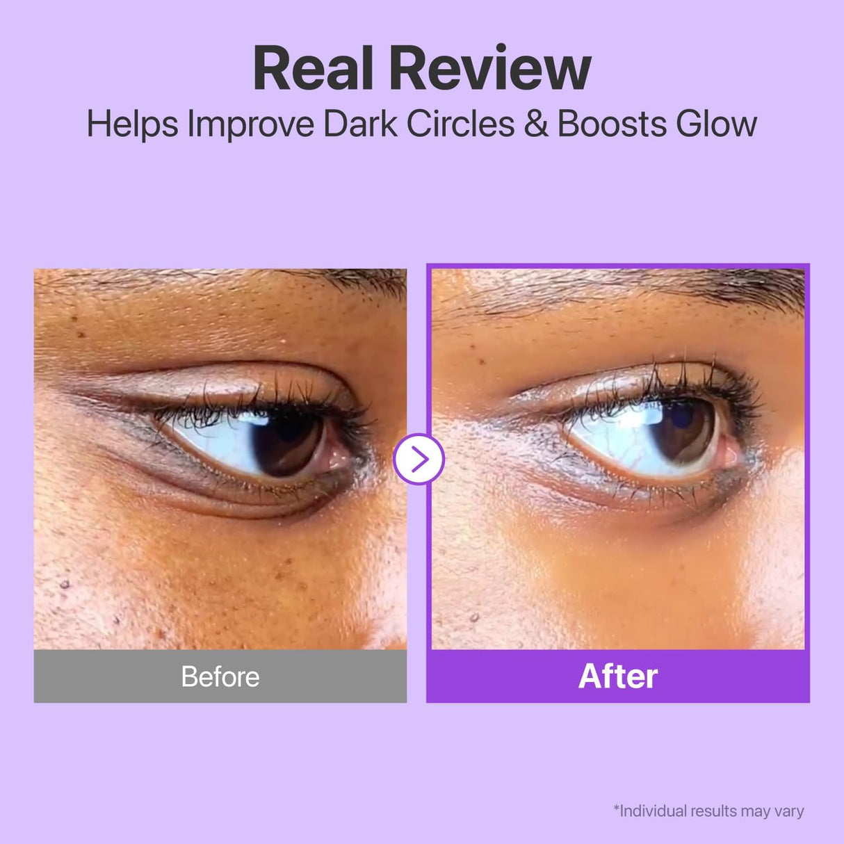 NUMBUZIN | No.9 NAD+ Retinol Volumetox Eye Cream - 10ml