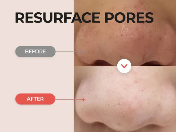 NUMBUZIN | No.4 Pore Zero Peeled Egg Toner Pad - 70ud - InternationalCosmetic