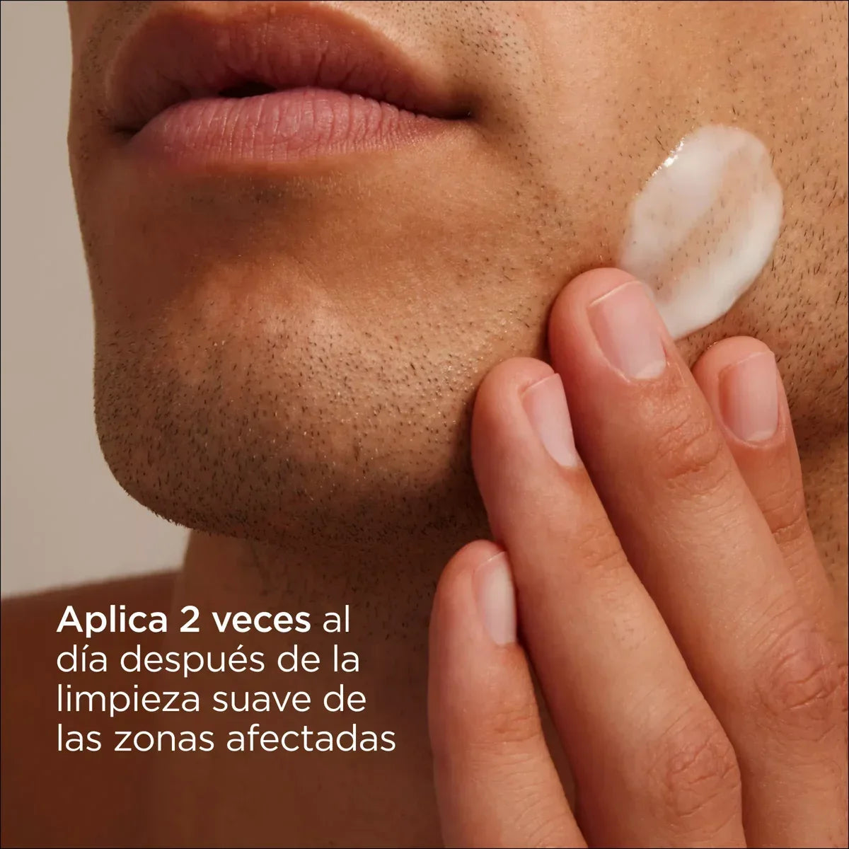 ISDIN | NUTRADEICA® Seborrheic Skin Facial Gel Cream - 50ml - InternationalCosmetic