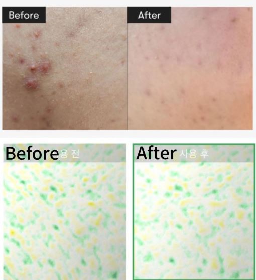 VT COSMETICS | Cosmetics Reti‑A Reedle Shot 700 - 30ml