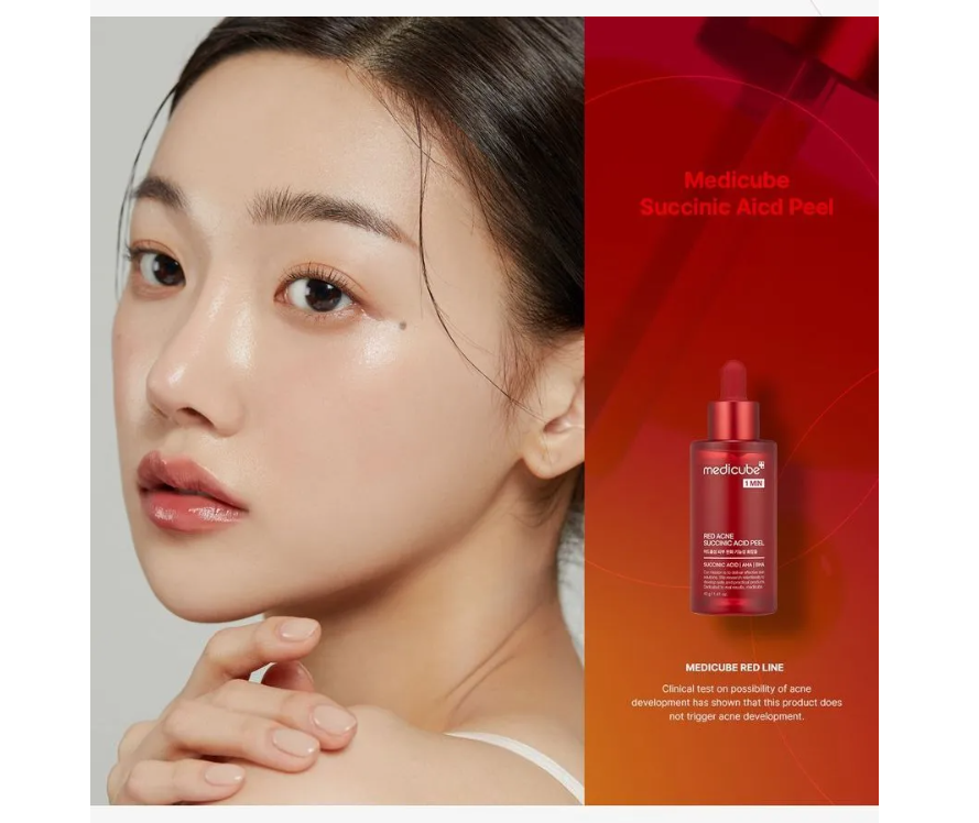 RED ACNE SUCCINIC ACID PEEL