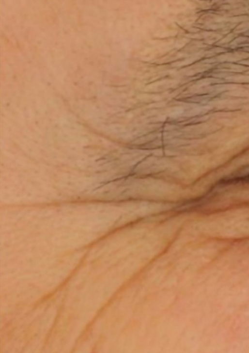 PRIMADERM | Retinal Renewal 0.2% GF & Peptide Serum - 30ml