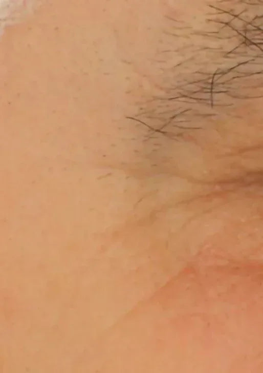 PRIMADERM | Retinal Renewal 0.2% GF & Peptide Serum - 30ml - InternationalCosmetic