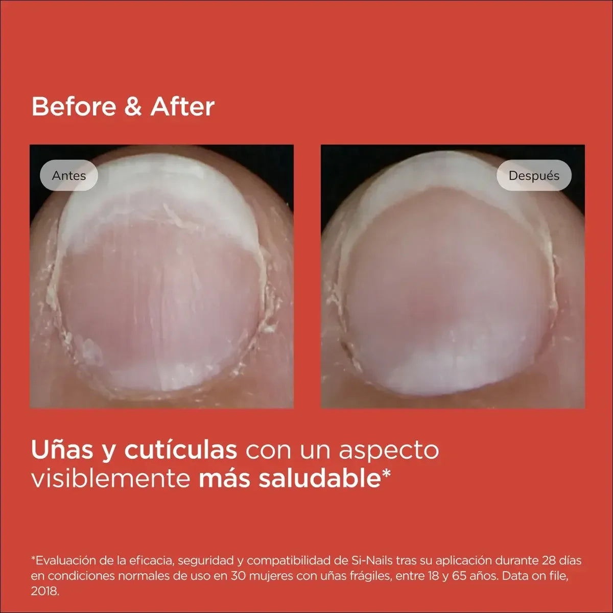 ISDIN | SI-NAILS® Fortalecedor de uñas - 2.5ml - InternationalCosmetic