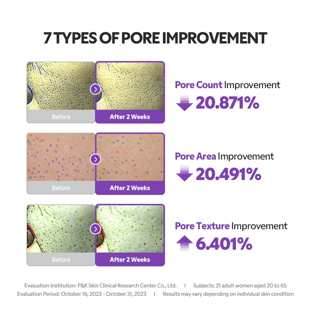 TIRTIR | Niacinamide 20% Serum - 30 ml