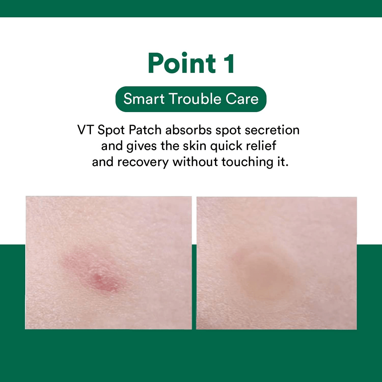 VT COSMETICS | Spot Patch - 48ud