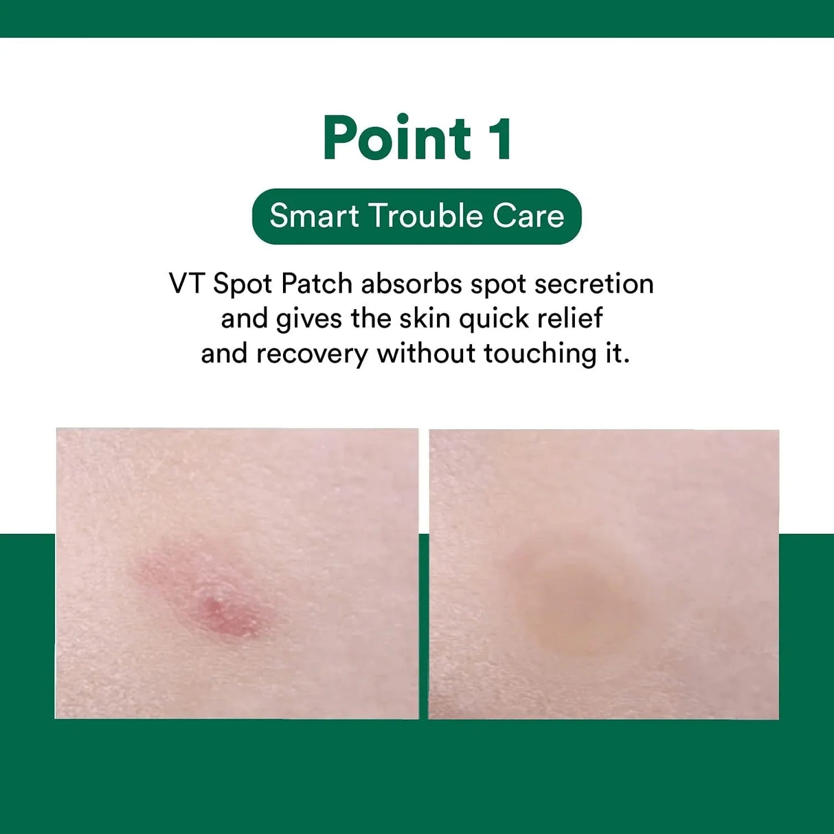 VT COSMETICS | Spot Patch - 48ud - InternationalCosmetic