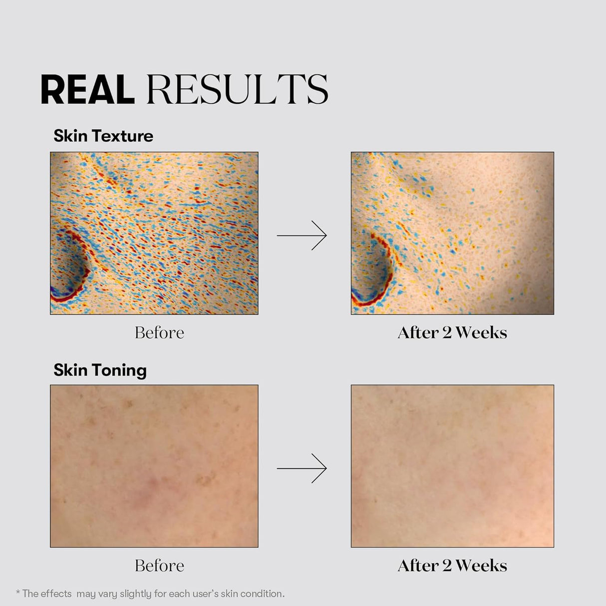 VT COSMETICS | TX‑Toning Daily Mask