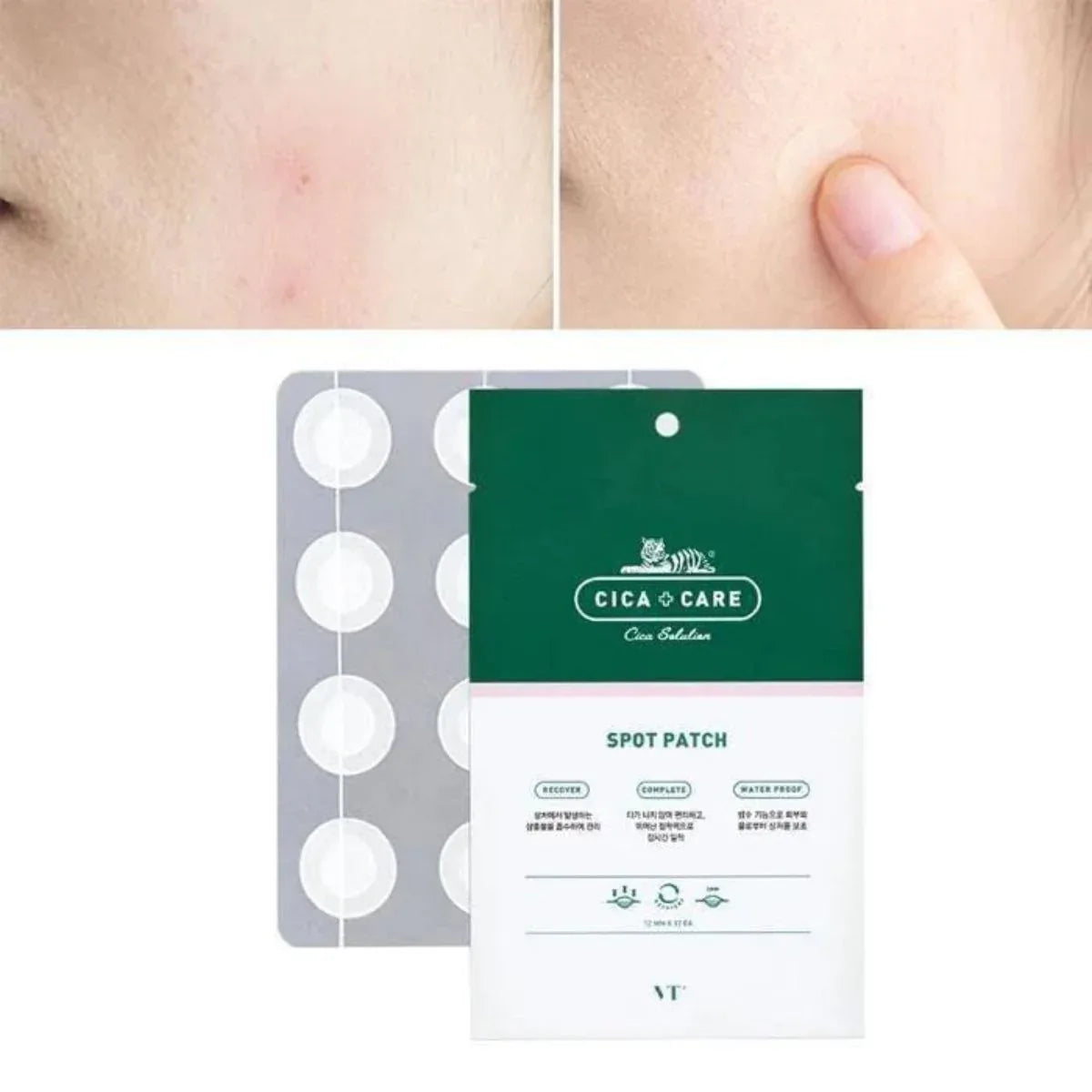 VT COSMETICS | Spot Patch - 48ud - InternationalCosmetic