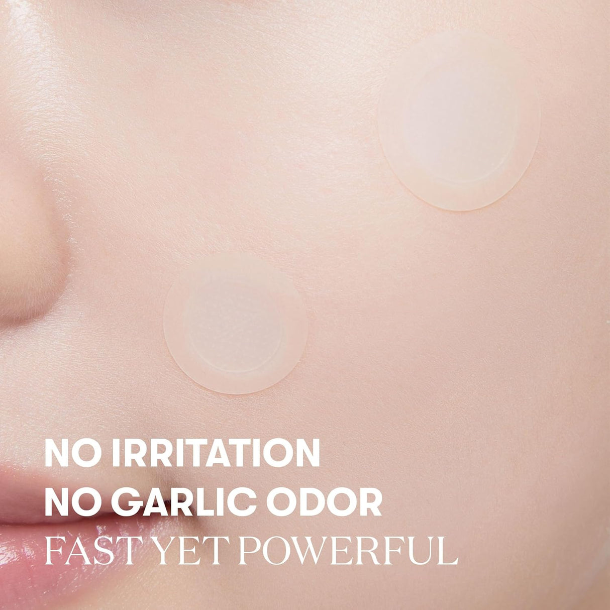 VT COSMETICS | Garlic AC Reedle Shot Point Patch - 9ud