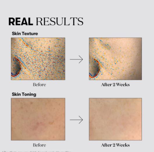 VT COSMETICS | Tx‑Toning Cream - 50ml