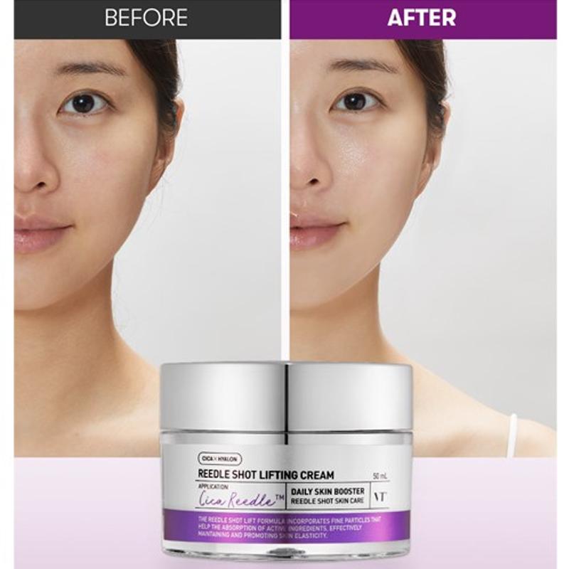 VT COSMETICS | Reedle Shot Lifting Cream - 50ml