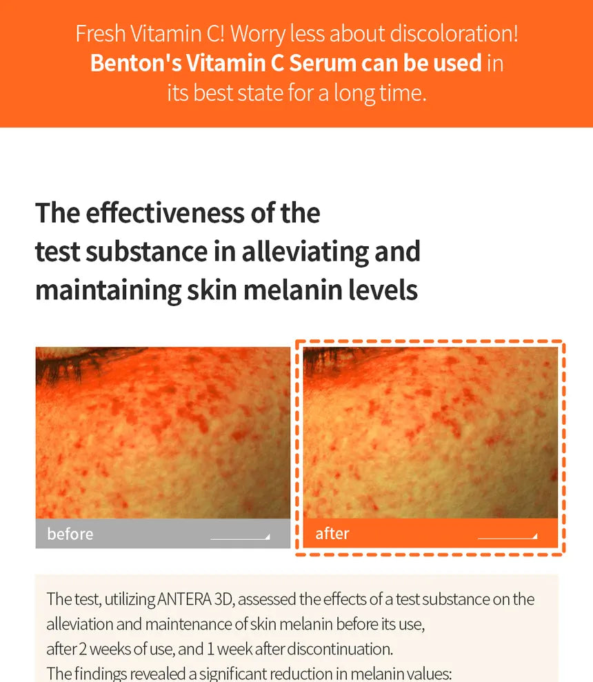 BENTON | Vitamin C Serum 20% - 30ml