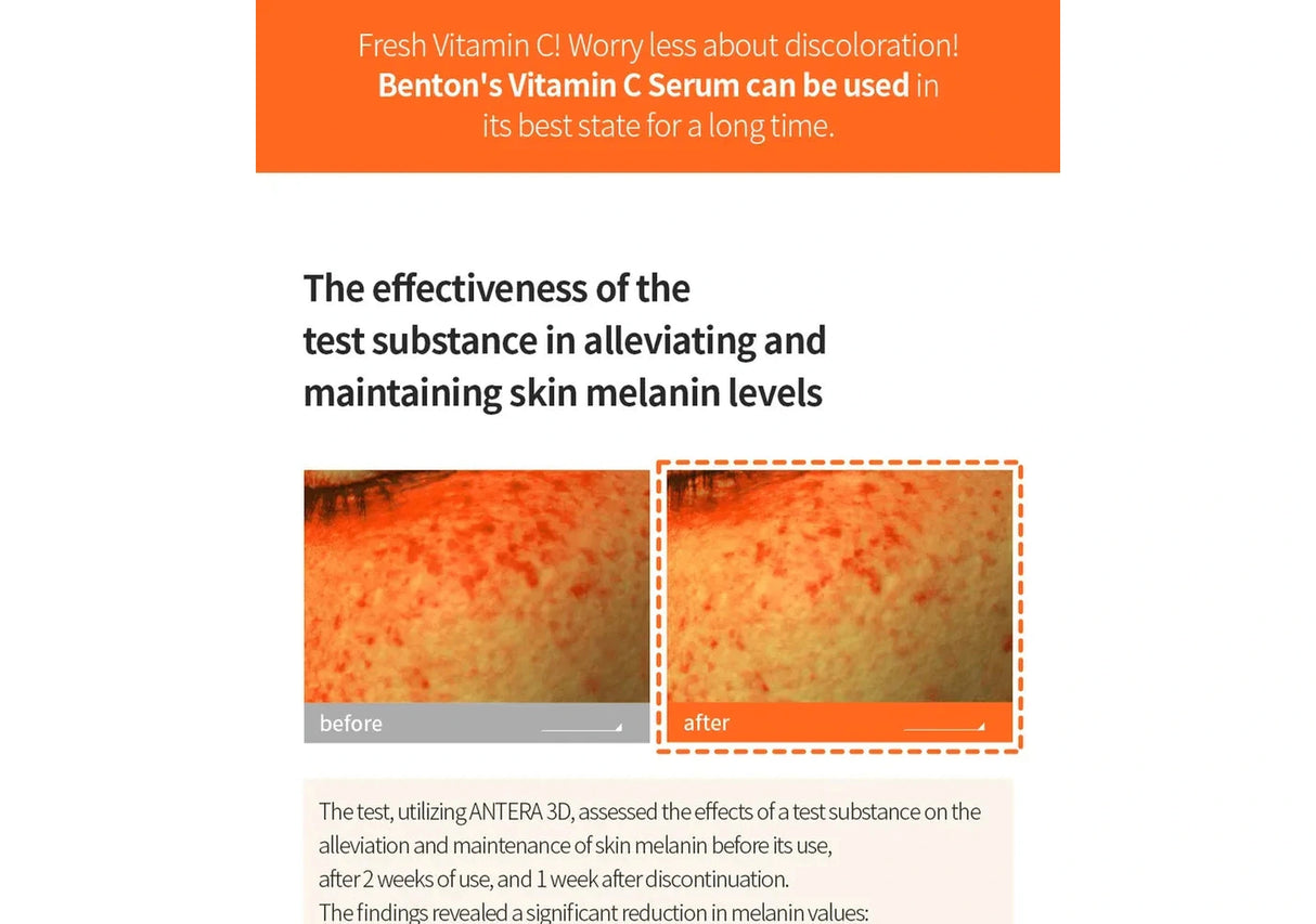 BENTON | Vitamin C Serum 20% - 30ml