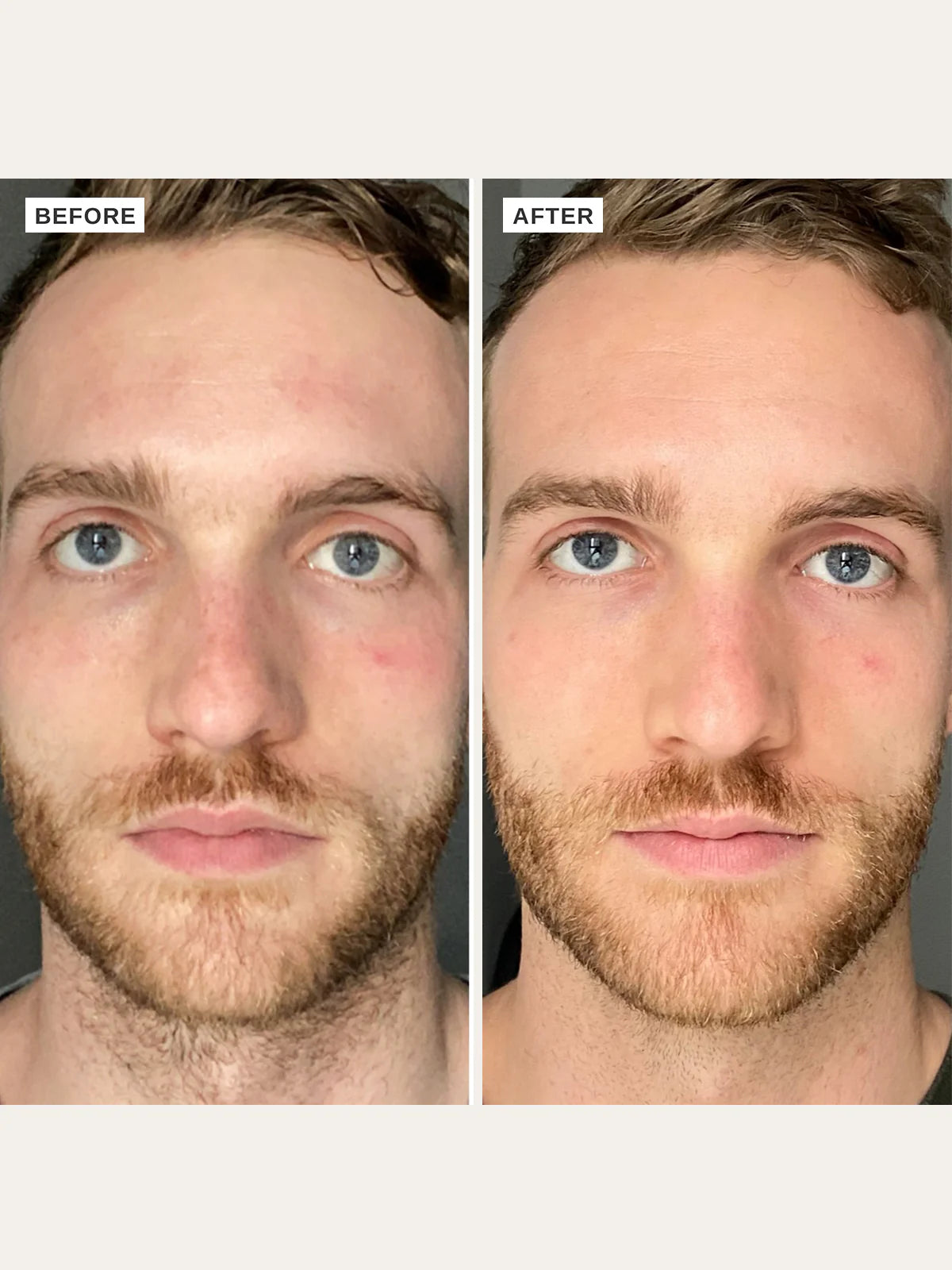 ALPHA-H | Vitamin B Serum